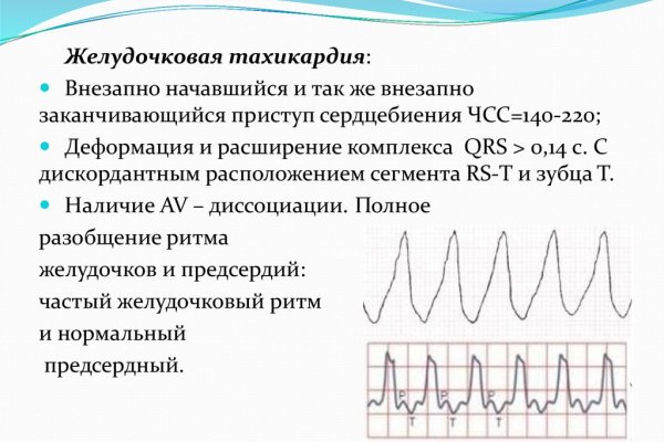 Что случилось с кракеном маркетплейс